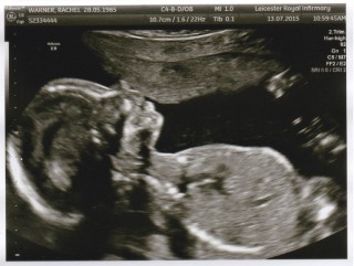 20_weeks_scan_july_2015_2