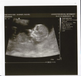 3_month_baby_scan_may_2015_2