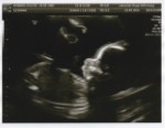 20 Weeks Scan July 2015 3