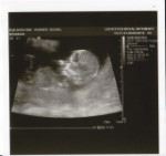 3 Month Baby Scan May 2015 2